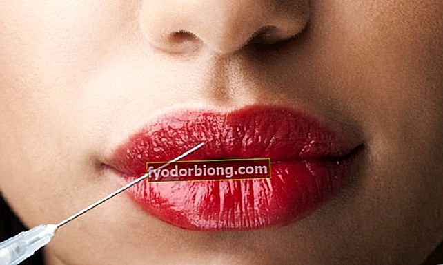 Botox: co je a jaké je použití botulotoxinu