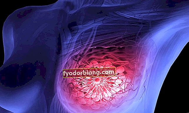 8 brystkræft symptomer, der går langt ud over klumpen